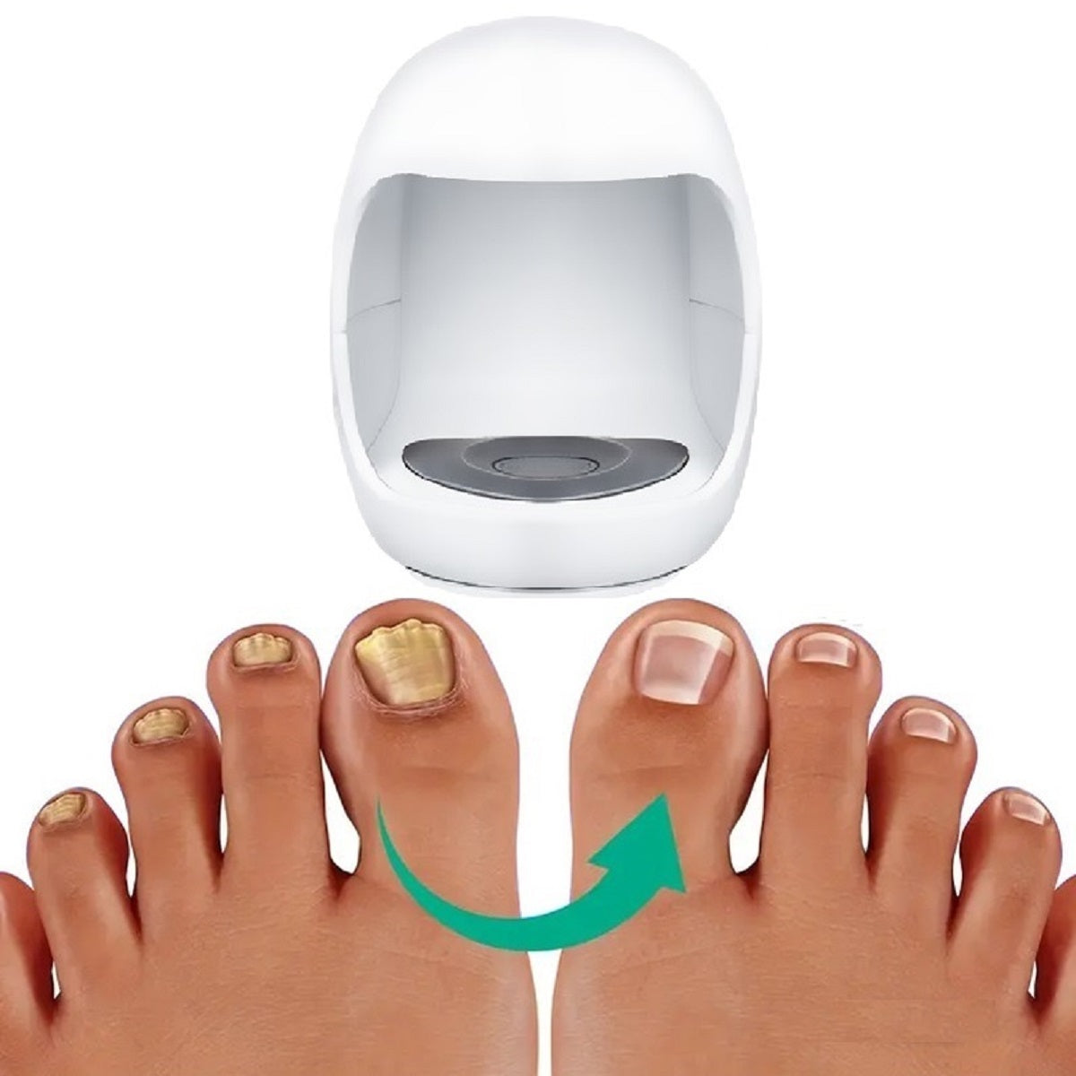 Nails Fungus Cleaning Laser Device