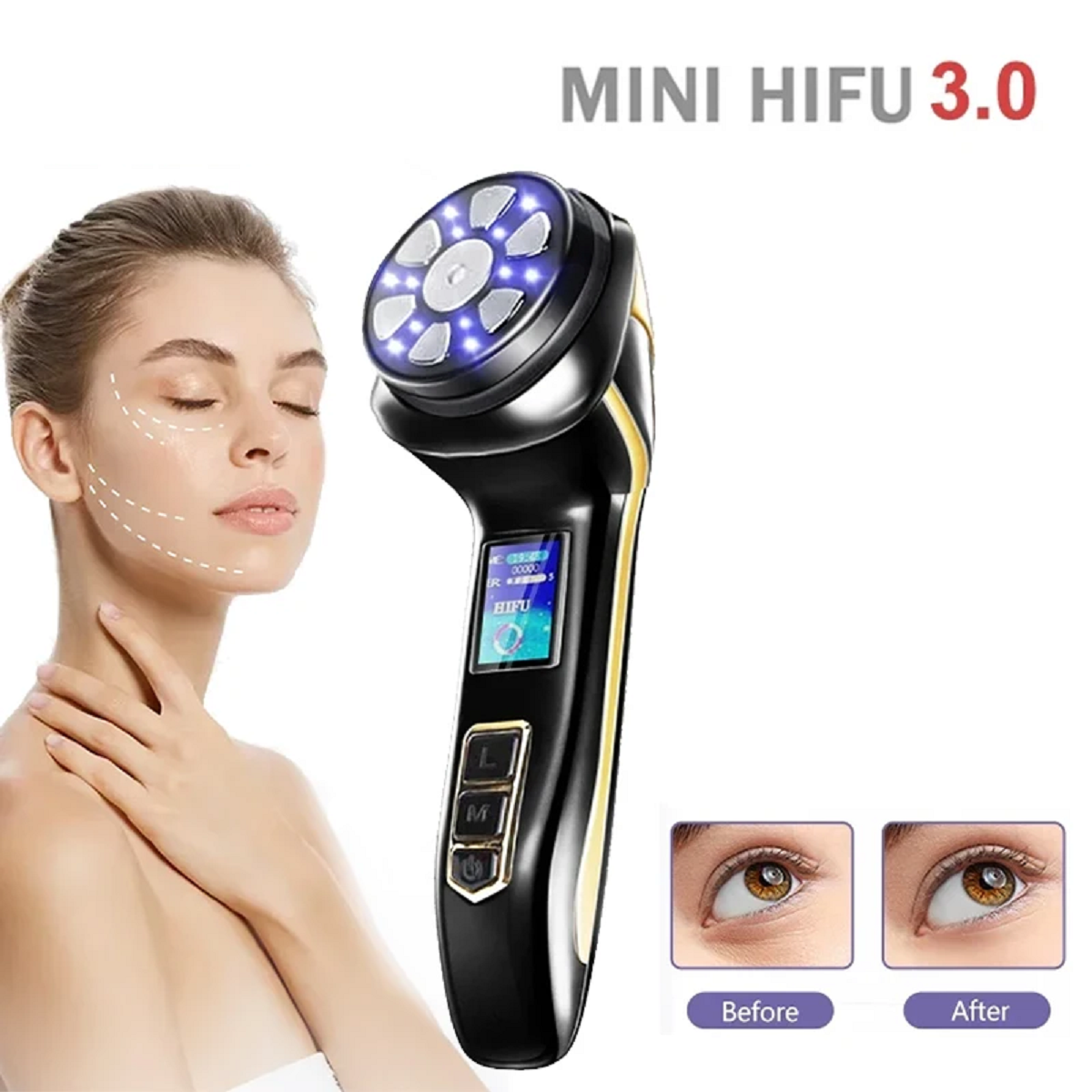 4 In1 Ultrasonic Micro Current Face Lift Wrinkle Resistant Massager Machine