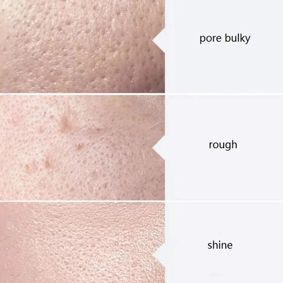 Facial Serum Kit – AS1 SA2 AO3 Aqua Peel Solutions for Hydra Machine