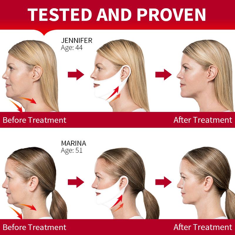 icicosmetic lifting mask (5 masks)