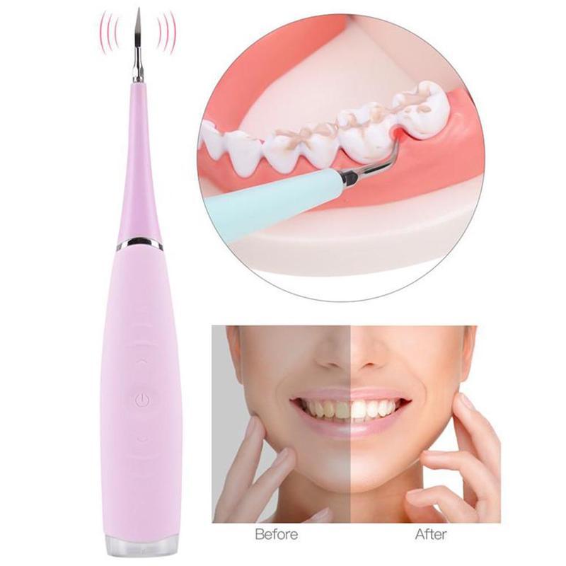ORALCLEAN ULTRASONIC TOOTH CLEANER