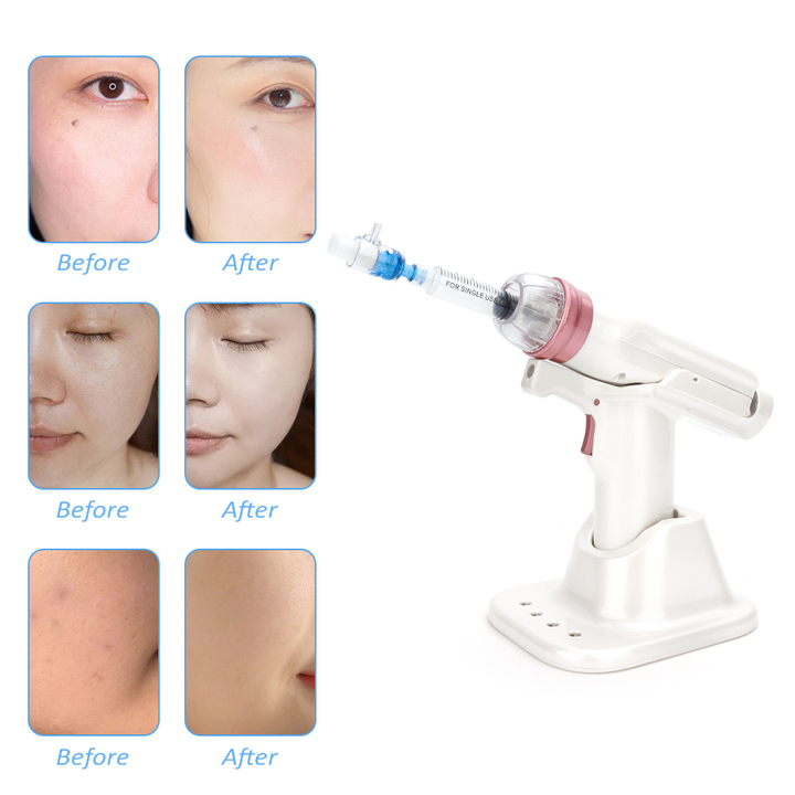 Mesotherapy hydrolifting water injector beauty device iciCosmetic™
